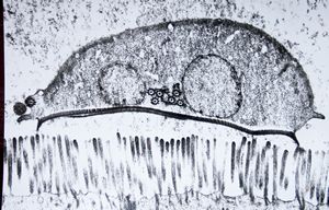 Giardia (lamblia) intestinalis Giardia (lamblia) intestinalis
